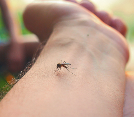 Do you know what bug bit you? These are the 5 most common bites and some tips to soothe the itch